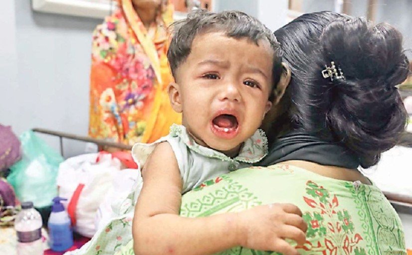 হাম ও হামের উপসর্গে মৃত্যু ৯০০ ছাড়াল